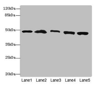 Western blot | All lanes: PSMD13antibody at 3.42μg/ml | Lane 1: Mouse lung tissue | Lane 2: 293T whole cell lysate | Lane 3: Hela whole cell lysate | Lane 4: HepG2 whole cell lysate | Lane 5: Jurkat whole cell lysate | Secondary | Goat polyclonal to rabbit IgG at 1/10000 dilution | Predicted band size: 43 kDa | Observed band size: 43 kDaRabbit anti-Human PSMD13 Polyclonal Antibody