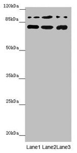 Western blot | All lanes: COG5 antibody at 2.04 μg/ml | Lane 1: Mouse large intestine tissue | Lane 2: A549 whole cell lysate | Lane 3: 293T whole cell lysate | Secondary | Goat polyclonal to rabbit IgG at 1/10000 dilution | Predicted band size: 93, 95, 91 kDa | Observed band size: 93, 70 kDaRabbit anti-Human COG5 Polyclonal Antibody