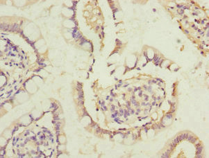 Immunohistochemistry of paraffin-embedded human small intestine tissue using DHDH Antibody at dilution of 1:100Rabbit anti-Human DHDH Polyclonal Antibody