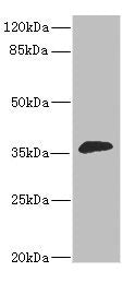 Western blot | All lanes: DHDH antibody at 1.4μg/ml + Mouse liver tissue | Secondary | Goat polyclonal to rabbit IgG at 1/10000 dilution | Predicted band size: 36 kDa | Observed band size: 36 kDaRabbit anti-Human DHDH Polyclonal Antibody