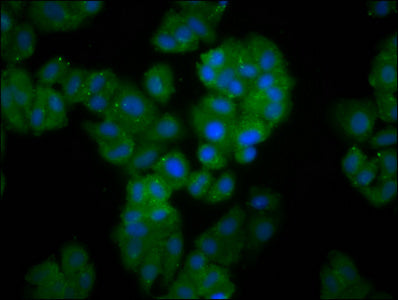 Immunofluorescence staining of HepG2 cells with FBXO10 Antibody at 1:166, counter-stained with DAPI. The cells were fixed in 4% formaldehyde, permeabilized using 0.2% Triton X-100 and blocked in 10% normal Goat Serum. The cells were then incubated with the antibody overnight at 4°C. The secondary antibody was Alexa Fluor 488-congugated AffiniPure Goat Anti-Rabbit IgG(H+L).Rabbit anti-Human FBXO10 Polyclonal Antibody