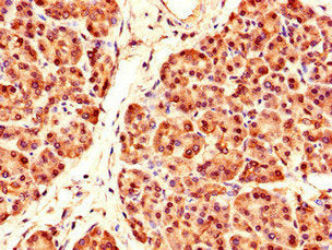 Immunohistochemistry of paraffin-embedded human pancreatic tissue using PRDM4 Antibody at dilution of 1:100Rabbit anti-Human PRDM4 Polyclonal Antibody