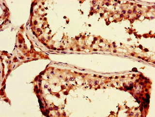 Immunohistochemistry of paraffin-embedded human testis tissue using PRDM4 Antibody at dilution of 1:100Rabbit anti-Human PRDM4 Polyclonal Antibody