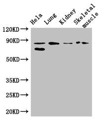 Western Blot | Positive WB detected in: Hela whole cell lysate, Mouse lung tissue, Mouse kidney tissue, Mouse skeletal muscle tissue | All lanes: PRDM4 antibody at 3.4μg/ml | Secondary | Goat polyclonal to rabbit IgG at 1/50000 dilution | Predicted band size: 88 kDa | Observed band size: 88, 70 kDaRabbit anti-Human PRDM4 Polyclonal Antibody