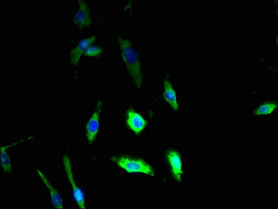 Immunofluorescent analysis of U251 cells using the antibody at dilution of 1:100 and Alexa Fluor 488-congugated AffiniPure Goat Anti-Rabbit IgG(H+L)Rabbit anti-Human DSE Polyclonal Antibody