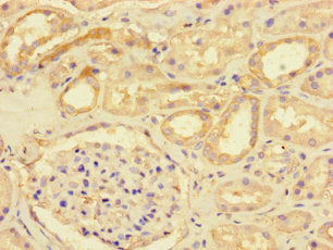 Immunohistochemistry of paraffin-embedded human kidney tissue using DSE Antibody at dilution of 1:100Rabbit anti-Human DSE Polyclonal Antibody