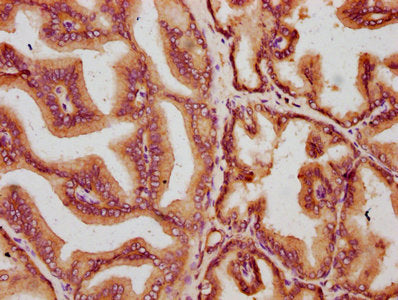 IHC image of MKLN1 Antibody diluted at 1:400 and staining in paraffin-embedded human prostate tissue performed on a Leica BondTM system. After dewaxing and hydration, antigen retrieval was mediated by high pressure in a citrate buffer (pH 6.0). Section was blocked with 10% normal goat serum 30min at RT. Then primary antibody (1% BSA) was incubated at 4°C overnight. The primary is detected by a biotinylated secondary antibody and visualized using an HRP conjugated SP system.
