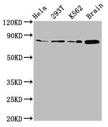 Western Blot  | Positive WB detected in: Hela whole cell lysate, 293T whole cell lysate, K562 whole cell lysate, Rat brain tissue  | All lanes: MKLN1 antibody at 2.7µg/ml  | Secondary  | Goat polyclonal to rabbit IgG at 1/50000 dilution  | Predicted band size: 85, 61 kDa  | Observed band size: 85 kDa