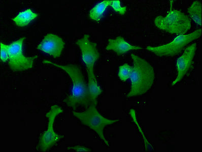 Immunofluorescence staining of U251 cells with WWC3 Antibody at 1:50, counter-stained with DAPI. The cells were fixed in 4% formaldehyde, permeabilized using 0.2% Triton X-100 and blocked in 10% normal Goat Serum. The cells were then incubated with the antibody overnight at 4°C. The secondary antibody was Alexa Fluor 488-congugated AffiniPure Goat Anti-Rabbit IgG(H+L).Rabbit anti-Human WWC3 Polyclonal Antibody