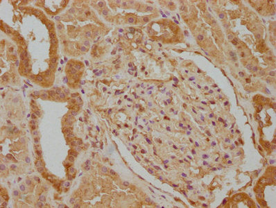 IHC image of the antibody diluted at 1:100 and staining in paraffin-embedded human kidney tissue performed on a Leica BondTM system. After dewaxing and hydration, antigen retrieval was mediated by high pressure in a citrate buffer (pH 6.0). Section was blocked with 10% normal goat serum 30min at RT. Then primary antibody (1% BSA) was incubated at 4°C overnight. The primary is detected by a biotinylated secondary antibody and visualized using an HRP conjugated SP system.Rabbit anti-Human WWC3 Polyclonal Antibody