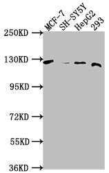 Western Blot | Positive WB detected in: MCF-7 whole cell lysate, SH-SY5Y whole cell lysate, HepG2 whole cell lysate, 293 whole cell lysate | All lanes: WWC3 antibody at 1:1000 | Secondary | Goat polyclonal to rabbit IgG at 1/50000 dilution | Predicted band size: 123, 66 kDa | Observed band size: 123 kDaRabbit anti-Human WWC3 Polyclonal Antibody
