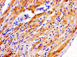 Immunohistochemistry of paraffin-embedded human heart tissue using NDRG4 Antibody at dilution of 1:100