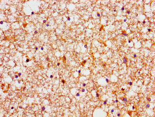 Immunohistochemistry of paraffin-embedded human brain tissue using NDRG4 Antibody at dilution of 1:100