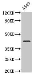 Western Blot  | Positive WB detected in: A549 whole cell lysate  | All lanes: NDRG4 antibody at 2µg/ml  | Secondary  | Goat polyclonal to rabbit IgG at 1/50000 dilution  | Predicted band size: 39, 38, 41, 43, 40 kDa  | Observed band size: 43 kDa
