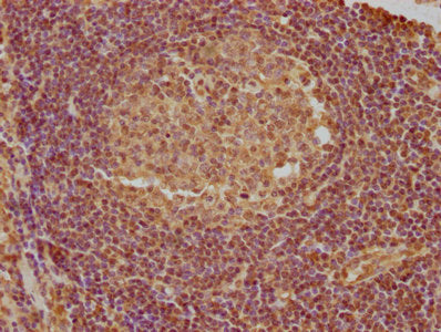 IHC image of PYCARD Antibody diluted at 1:740 and staining in paraffin-embedded human lymph node tissue performed on a Leica BondTM system. After dewaxing and hydration, antigen retrieval was mediated by high pressure in a citrate buffer (pH 6.0). Section was blocked with 10% normal goat serum 30min at RT. Then primary antibody (1% BSA) was incubated at 4°C overnight. The primary is detected by a biotinylated secondary antibody and visualized using an HRP conjugated SP system.Rabbit anti-Human PYCARD Polyclonal Antibody