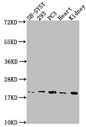 Western Blot | Positive WB detected in: SH-SY5Y whole cell lysate, 293 whole cell lysate, PC3 whole cell lysate, Mouse heart tissue, Mouse kidney tissue | All lanes: PYCARD antibody at 1:2000 | Secondary | Goat polyclonal to rabbit IgG at 1/50000 dilution | Predicted band size: 22, 20, 16 kDa | Observed band size: 20 kDaRabbit anti-Human PYCARD Polyclonal Antibody