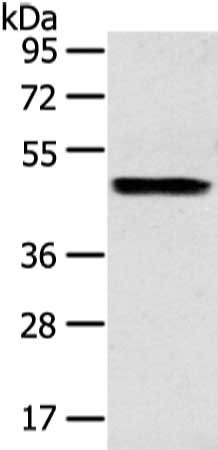 Gel: 8%SDS-PAGE, Lysate: 40 μg, Lane: Human liver cancer tissue, Primary antibody: ZPR1 Antibody(ZPR1 Antibody) at dilution 1/200 dilution, Secondary antibody: Goat anti rabbit IgG at 1/8000 dilution, Exposure time: 15 secondsRabbit anti-Human ZPR1 Polyclonal Antibody