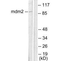 Western blot analysis of extracts from SKOV3 cells, using MDM2 antibody.
