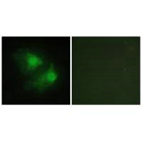Immunofluorescence analysis of HeLa cells, using LIMK2 antibody.Rabbit anti-Human LIMK2 Polyclonal Antibody