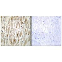 Immunohistochemistry analysis of paraffin-embedded human heart tissue using LIMK2 antibody.Rabbit anti-Human LIMK2 Polyclonal Antibody