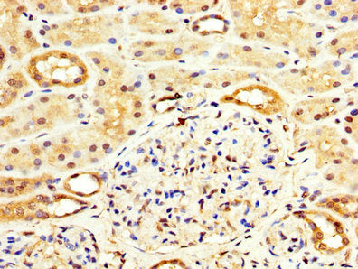 IHC image of WASF3 Antibody diluted at 1:100 and staining in paraffin-embedded human kidney tissue performed on a Leica BondTM system. After dewaxing and hydration, antigen retrieval was mediated by high pressure in a citrate buffer (pH 6.0). Section was blocked with 10% normal goat serum 30min at RT. Then primary antibody (1% BSA) was incubated at 4°C overnight. The primary is detected by a biotinylated secondary antibody and visualized using an HRP conjugated SP system.Rabbit anti-Human WASF3 Polyclonal Antibody