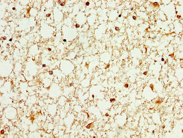 IHC image of WASF3 Antibody diluted at 1:100 and staining in paraffin-embedded human brain tissue performed on a Leica BondTM system. After dewaxing and hydration, antigen retrieval was mediated by high pressure in a citrate buffer (pH 6.0). Section was blocked with 10% normal goat serum 30min at RT. Then primary antibody (1% BSA) was incubated at 4°C overnight. The primary is detected by a biotinylated secondary antibody and visualized using an HRP conjugated SP system.Rabbit anti-Human WASF3 Polyclonal Antibody