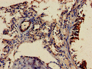 Immunohistochemistry of paraffin-embedded human lung tissue using SHOC2 Antibody at dilution of 1:100Rabbit anti-Human SHOC2 Polyclonal Antibody