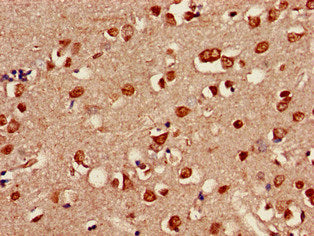 Immunohistochemistry of paraffin-embedded human brain tissue using SHOC2 Antibody at dilution of 1:100Rabbit anti-Human SHOC2 Polyclonal Antibody
