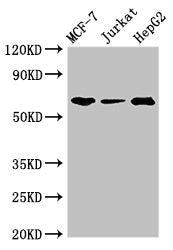 Western Blot | Positive WB detected in: MCF-7 whole cell lysate, Jurkat whole cell lysate, HepG2 whole cell lysate | All lanes: SHOC2 antibody at 3μg/ml | Secondary | Goat polyclonal to rabbit IgG at 1/50000 dilution | Predicted band size: 65, 60 kDa | Observed band size: 65 kDaRabbit anti-Human SHOC2 Polyclonal Antibody