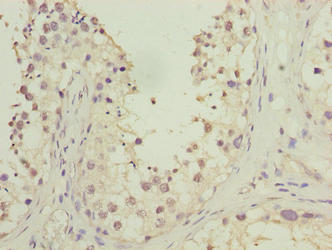 Immunohistochemistry of paraffin-embedded human testis tissue using HOOK1 Antibody at dilution of 1:100Rabbit anti-Human HOOK1 Polyclonal Antibody