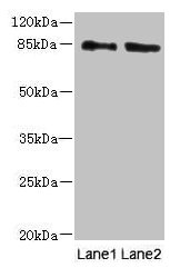 Western blot | All lanes: HOOK1 antibody at 4μg/ml | Lane 1: 293T whole cell lysate | Lane 2: MCF-7 whole cell lysate | Secondary | Goat polyclonal to rabbit IgG at 1/10000 dilution | Predicted band size: 85, 81 kDa | Observed band size: 85 kDaRabbit anti-Human HOOK1 Polyclonal Antibody