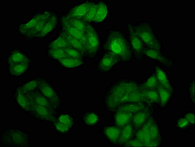 Immunofluorescence staining of HepG2 cells with NUDT5 Antibody at 1:200, counter-stained with DAPI. The cells were fixed in 4% formaldehyde, permeabilized using 0.2% Triton X-100 and blocked in 10% normal Goat Serum. The cells were then incubated with the antibody overnight at 4°C. The secondary antibody was Alexa Fluor 488-congugated AffiniPure Goat Anti-Rabbit IgG(H+L).Rabbit anti-Human NUDT5 Polyclonal Antibody