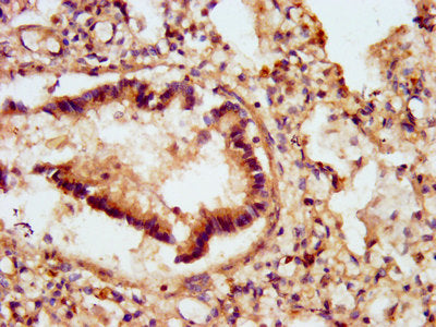 IHC image of GJD2 Antibody diluted at 1:500 and staining in paraffin-embedded human lung tissue performed on a Leica BondTM system. After dewaxing and hydration, antigen retrieval was mediated by high pressure in a citrate buffer (pH 6.0). Section was blocked with 10% normal goat serum 30min at RT. Then primary antibody (1% BSA) was incubated at 4°C overnight. The primary is detected by a biotinylated secondary antibody and visualized using an HRP conjugated SP system.Rabbit anti-Human GJD2 Polyclonal Antibody