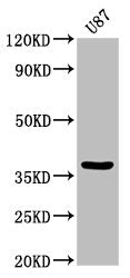 Western Blot  | Positive WB detected in: U87 whole cell lysate  | All lanes: GJD2 antibody at 3.2µg/ml  | Secondary  | Goat polyclonal to rabbit IgG at 1/50000 dilution  | Predicted band size: 37 kDa  | Observed band size: 37 kDaRabbit anti-Human GJD2 Polyclonal Antibody
