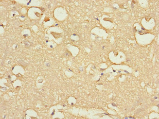 Immunohistochemistry of paraffin-embedded human brain tissue using FBXO4 Antibody at dilution of 1:100Rabbit anti-Human FBXO4 Polyclonal Antibody
