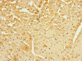 Immunohistochemistry of paraffin-embedded human heart tissue using FBXO4 Antibody at dilution of 1:100Rabbit anti-Human FBXO4 Polyclonal Antibody