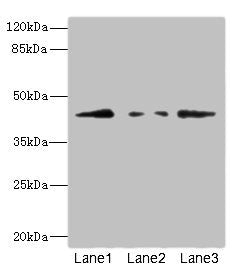 Western blot  | All lanes: FBXO4 antibody at 3.1μg/ml  | Lane 1: 293T whole cell lysate  | Lane 2: HepG2 whole cell lysate  | Lane 3: HL60 whole cell lysate  | Secondary  | Goat polyclonal to rabbit IgG at 1/10000 dilution  | Predicted band size: 45, 36 kDa  | Observed band size: 45 kDaRabbit anti-Human FBXO4 Polyclonal Antibody