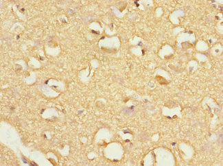 Immunohistochemistry of paraffin-embedded human brain tissue using the antibody at dilution of 1:100Rabbit anti-Human FBXO4 Polyclonal Antibody