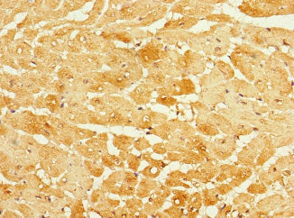Immunohistochemistry of paraffin-embedded human heart tissue using FBXO4 Antibody at dilution of 1:100Rabbit anti-Human FBXO4 Polyclonal Antibody