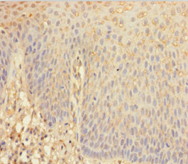 Immunohistochemistry of paraffin-embedded human tonsil tissue using ANGPTL2 Antibody at dilution of 1:100Rabbit anti-Human ANGPTL2 Polyclonal Antibody