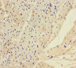Immunohistochemistry of paraffin-embedded human heart tissue using ANGPTL2 Antibody at dilution of 1:100Rabbit anti-Human ANGPTL2 Polyclonal Antibody