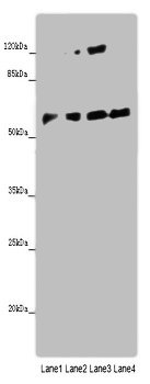 Western blot | All lanes: ANGPTL2 antibody at 8μg/ml | Lane 1: Mouse spleen tissue | Lane 2: K562 whole cell lysate | Lane 3: Hela whole cell lysate | Lane 4: A549 whole cell lysate | Secondary | Goat polyclonal to rabbit IgG at 1/10000 dilution | Predicted band size: 58, 23 kDa | Observed band size: 58 kDaRabbit anti-Human ANGPTL2 Polyclonal Antibody
