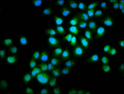Immunofluorescence staining of Hela cells with INTU Antibody at 1:100, counter-stained with DAPI. The cells were fixed in 4% formaldehyde, permeabilized using 0.2% Triton X-100 and blocked in 10% normal Goat Serum. The cells were then incubated with the antibody overnight at 4°C. The secondary antibody was Alexa Fluor 488-congugated AffiniPure Goat Anti-Rabbit IgG(H+L).