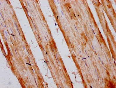 IHC image of INTU Antibody diluted at 1:300 and staining in paraffin-embedded human skeletal muscle tissue performed on a Leica BondTM system. After dewaxing and hydration, antigen retrieval was mediated by high pressure in a citrate buffer (pH 6.0). Section was blocked with 10% normal goat serum 30min at RT. Then primary antibody (1% BSA) was incubated at 4°C overnight. The primary is detected by a biotinylated secondary antibody and visualized using an HRP conjugated SP system.