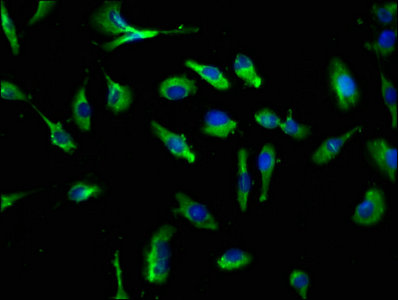 Immunofluorescence staining of U251 cells with CLEC4E Antibody at 1:250, counter-stained with DAPI. The cells were fixed in 4% formaldehyde, permeabilized using 0.2% Triton X-100 and blocked in 10% normal Goat Serum. The cells were then incubated with the antibody overnight at 4°C. The secondary antibody was Alexa Fluor 488-congugated AffiniPure Goat Anti-Rabbit IgG(H+L).Rabbit anti-Human CLEC4E Polyclonal Antibody