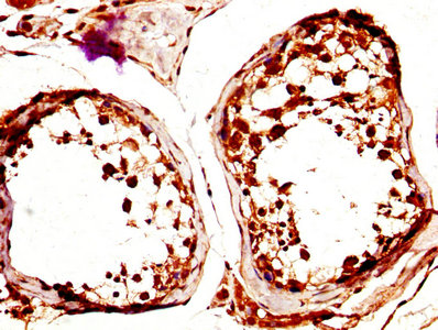IHC image of the antibody diluted at 1:600 and staining in paraffin-embedded human testis tissue performed on a Leica BondTM system. After dewaxing and hydration, antigen retrieval was mediated by high pressure in a citrate buffer (pH 6.0). Section was blocked with 10% normal goat serum 30min at RT. Then primary antibody (1% BSA) was incubated at 4°C overnight. The primary is detected by a biotinylated secondary antibody and visualized using an HRP conjugated SP system.Rabbit anti-Human CLEC4E Polyclonal Antibody