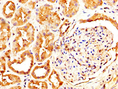 IHC image of CLEC4E Antibody diluted at 1:600 and staining in paraffin-embedded human kidney tissue performed on a Leica BondTM system. After dewaxing and hydration, antigen retrieval was mediated by high pressure in a citrate buffer (pH 6.0). Section was blocked with 10% normal goat serum 30min at RT. Then primary antibody (1% BSA) was incubated at 4°C overnight. The primary is detected by a biotinylated secondary antibody and visualized using an HRP conjugated SP system.Rabbit anti-Human CLEC4E Polyclonal Antibody