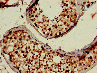 Immunohistochemistry of paraffin-embedded human testis tissue using USP18 Antibody at dilution of 1:100Rabbit anti-Human USP18 Polyclonal Antibody