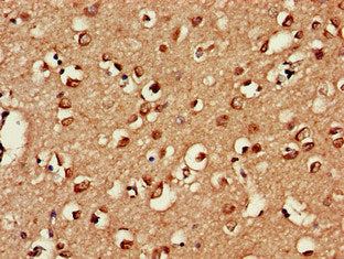 Immunohistochemistry of paraffin-embedded human brain tissue using USP18 Antibody at dilution of 1:100Rabbit anti-Human USP18 Polyclonal Antibody