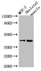 Western Blot | Positive WB detected in: MCF-7 whole cell lysate, Mouse skeletal muscle tissue | All lanes: USP18 antibody at 2μg/ml | Secondary | Goat polyclonal to rabbit IgG at 1/50000 dilution | Predicted band size: 44, 42 kDa | Observed band size: 44 kDaRabbit anti-Human USP18 Polyclonal Antibody